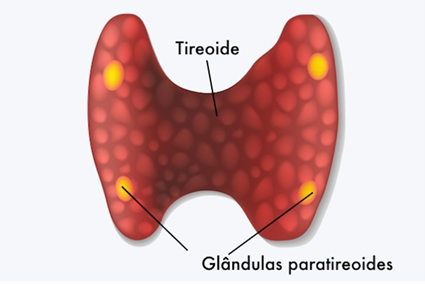 tireoidectomia